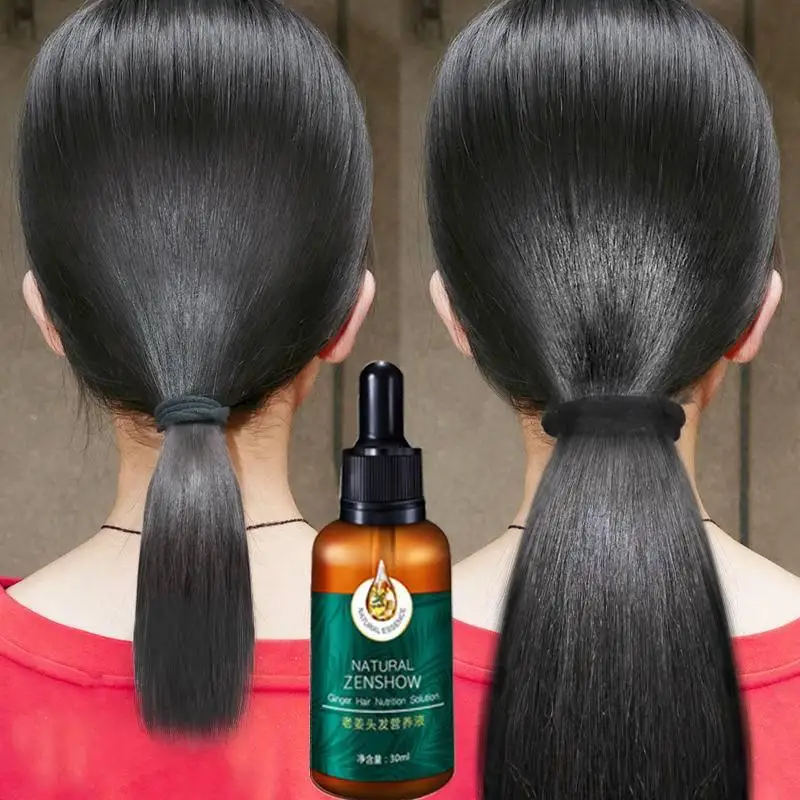 Hair Care Herbal Products - زيت عطري لنمو الشعر بالزنجبيل ،