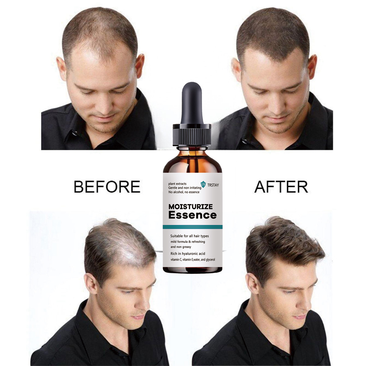 Hair Care Ordinary - 2022 جديد جوهر نمو الشعر يعزز