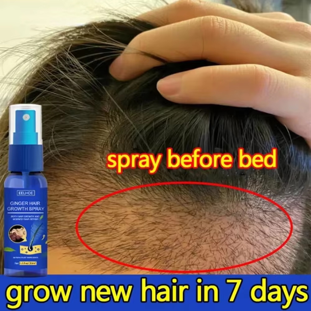 Hair Growth Serum Oil - بخاخ الزنجبيل السريع لنمو الشعر، مصل