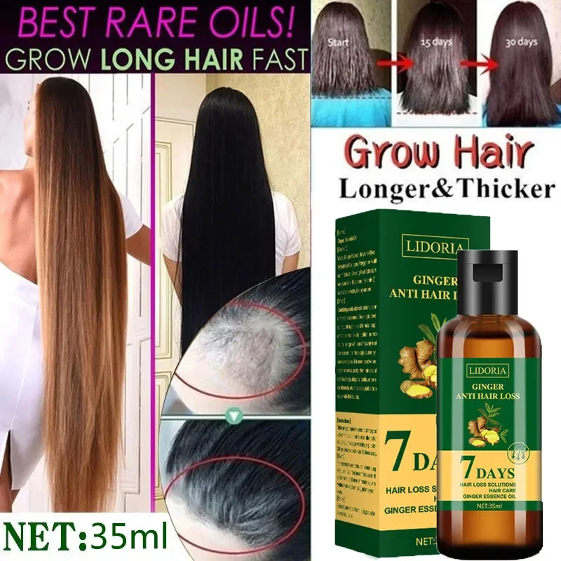 زيت عطري لنمو شعر الزنجبيل ، م - مراجعة Hair Care Essential Oil Atomizing وسعره
