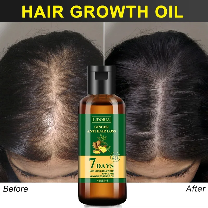 زيت عطري لنمو شعر الزنجبيل ، م - مراجعة Hair Care Essential Oil Atomizing وسعره