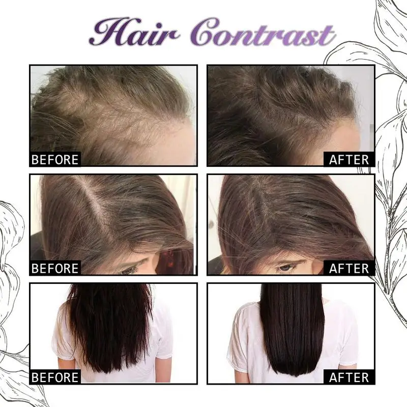 30 مل مصل البصل وإكليل الجبل ا - مراجعة Hair Care Ordinary وسعره
