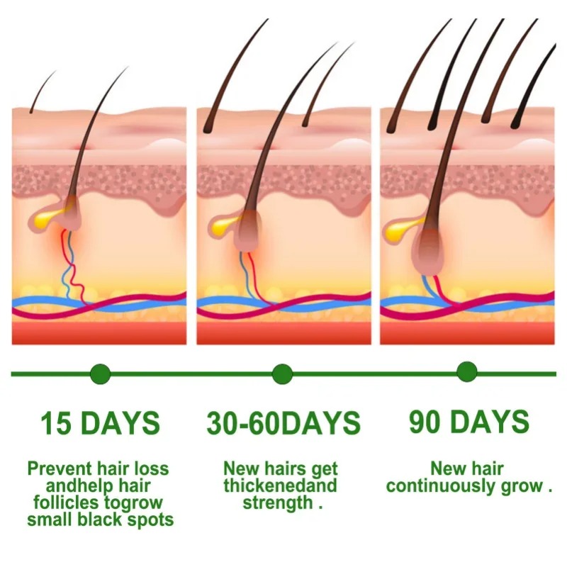 مصل نمو الشعر مجموعة العناية ب - مراجعة Hair Care Essential Oil Atomizing وسعره