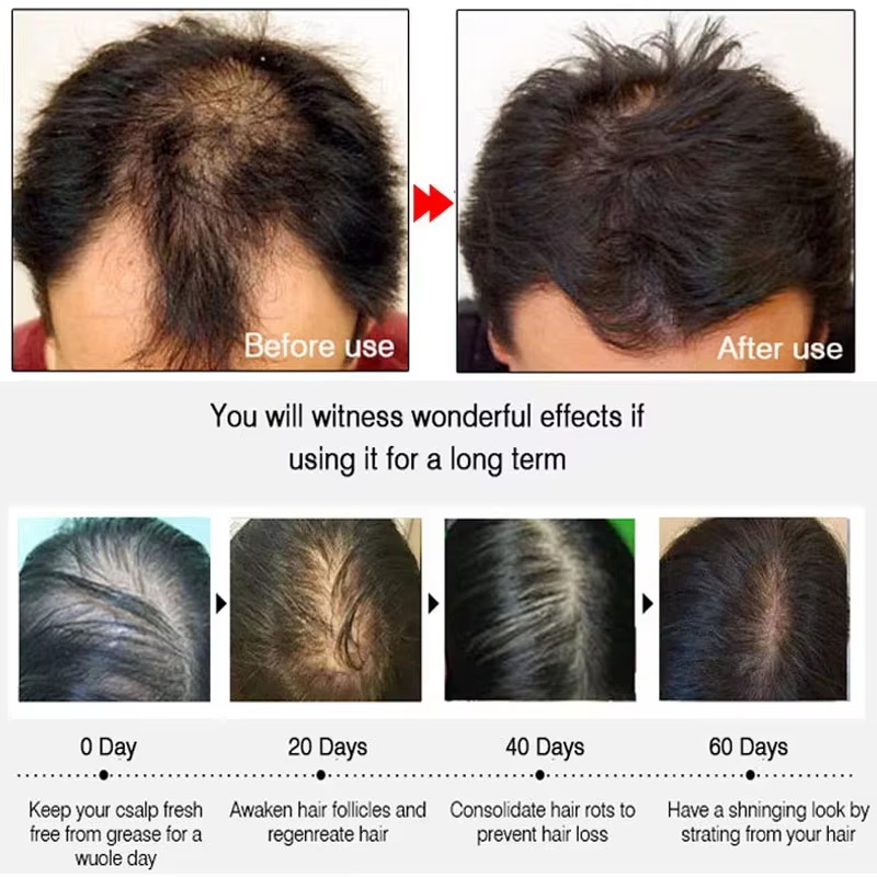 بخاخ الزنجبيل السريع لنمو الشع - مراجعة Hair Growth Serum Oil وسعره